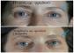 images/surgery/PicMonkey_Collage_2_text.jpg