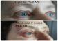 images/surgery/PicMonkey_Collage_text.jpg