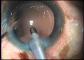 images/surgery/hqdefault_1.jpg